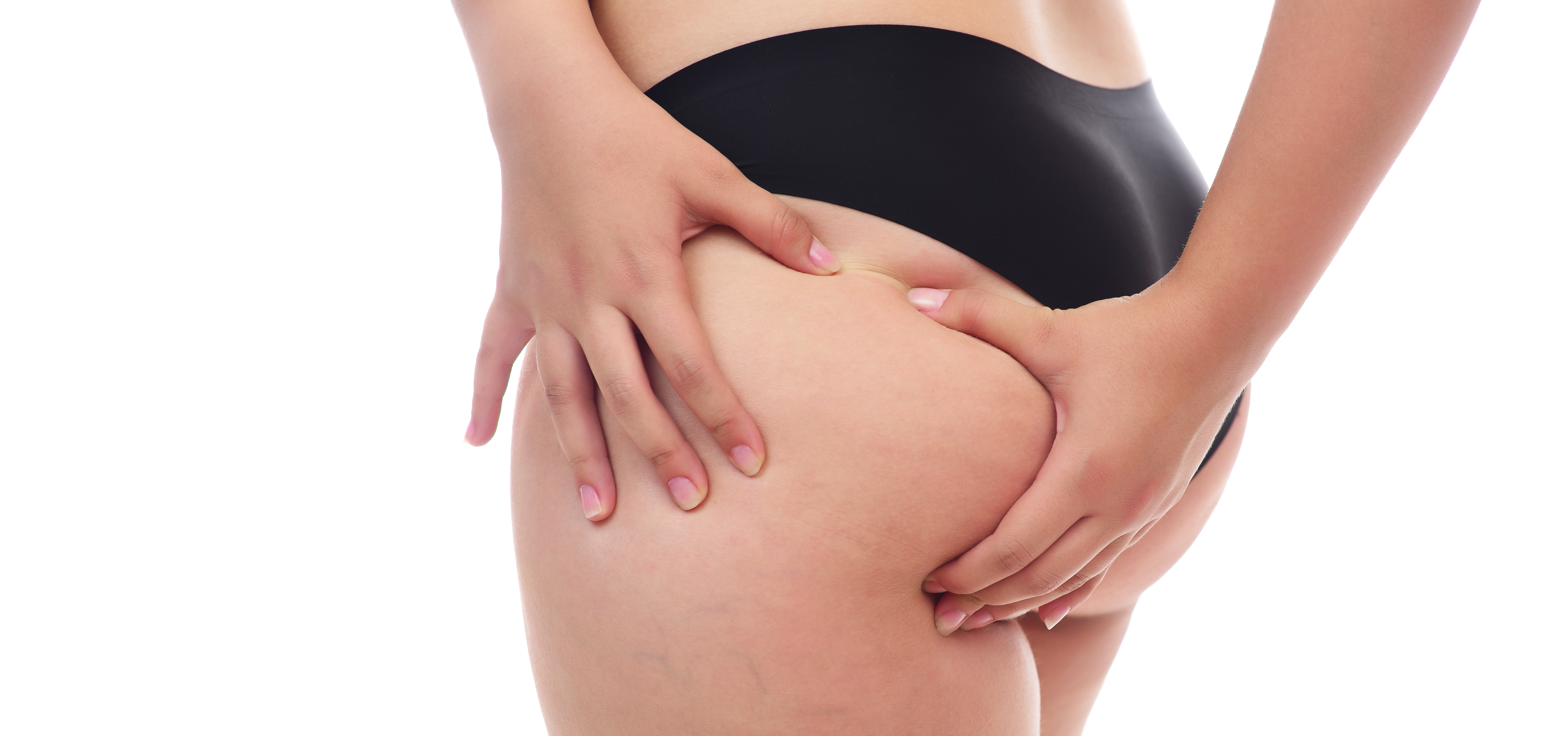 Non-surgical cellulite reduction therapy for women