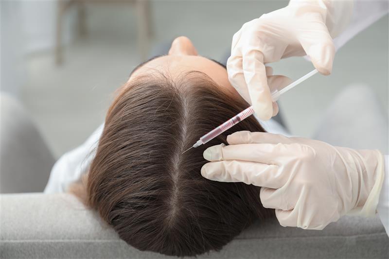 Hair Exosome Needling Treatment