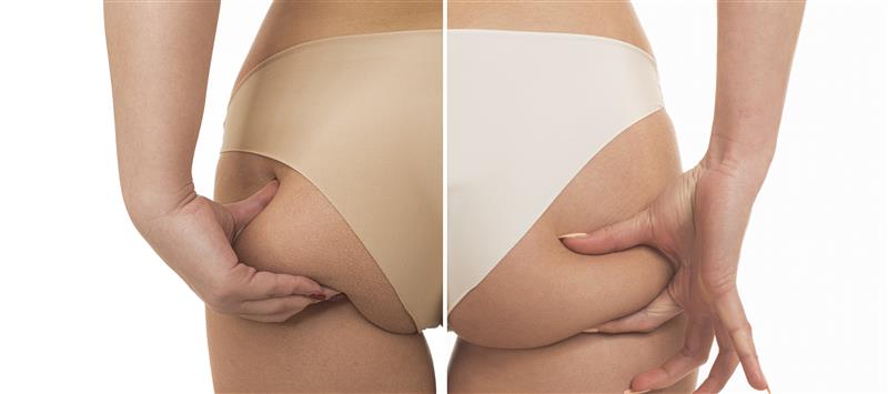 shape