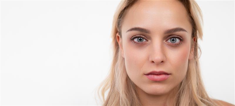 Blepharoplasty eyelid surgery