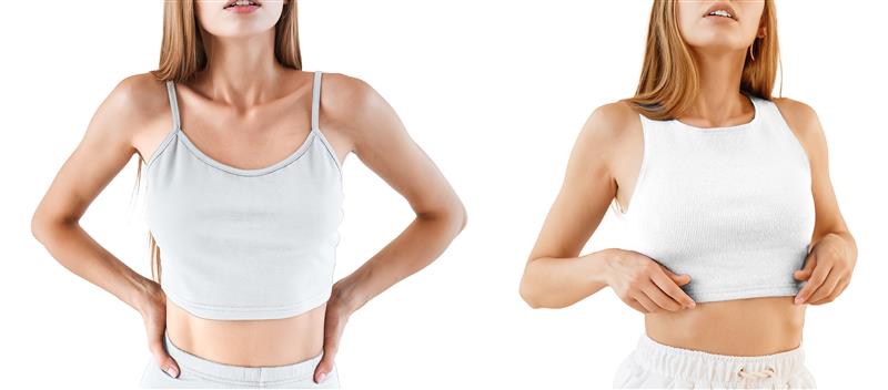 Before and after breast augmentation