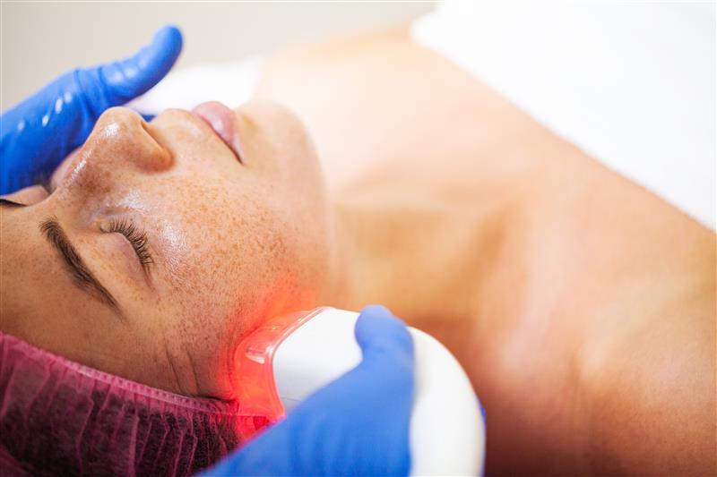 CO2 Fractional Laser Facial Treatment
