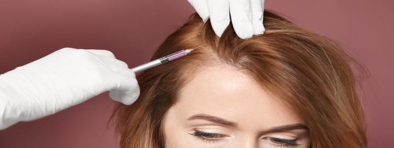 Mesotherapy Hair Treatment