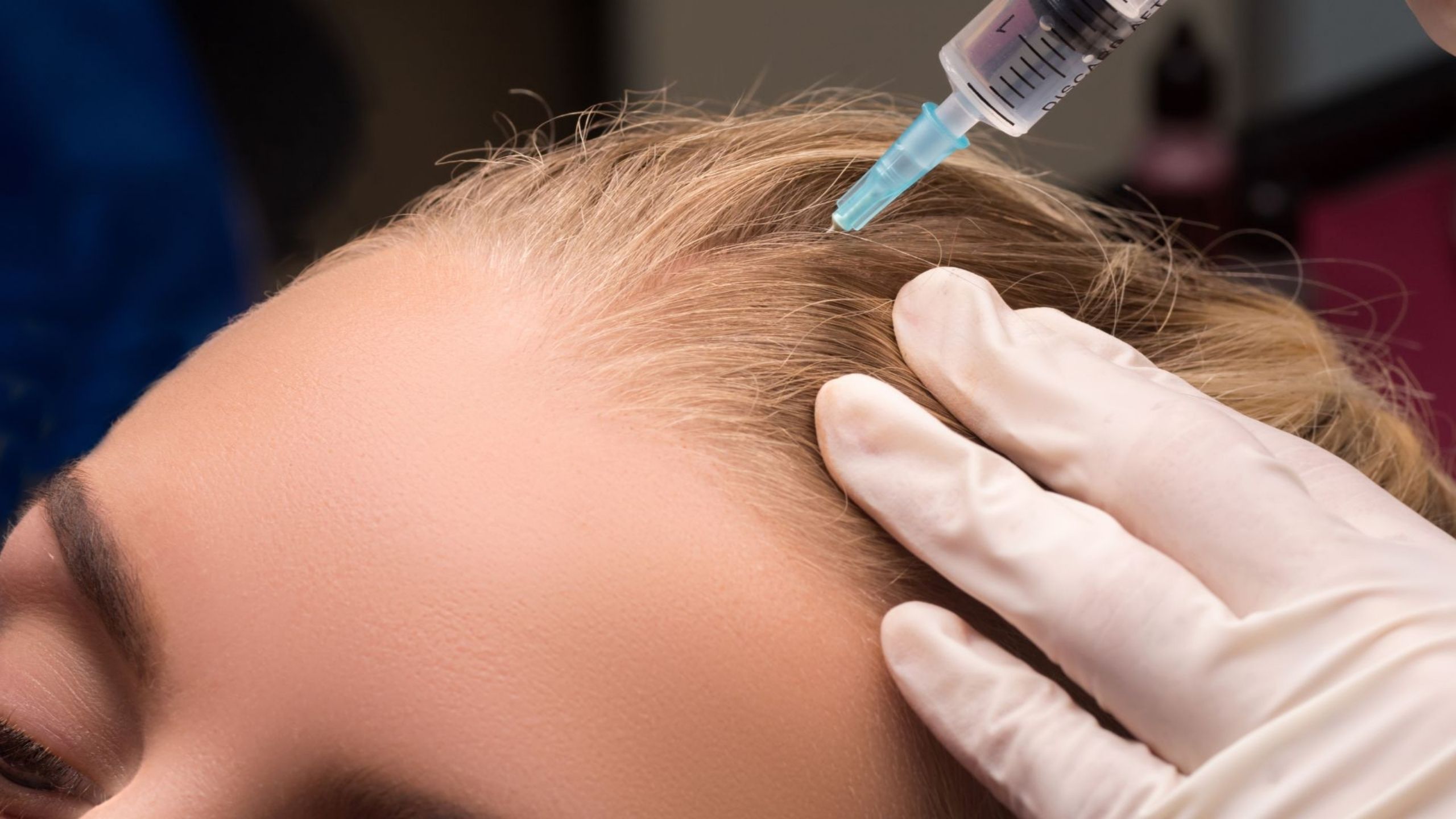 Mesotherapy treatment