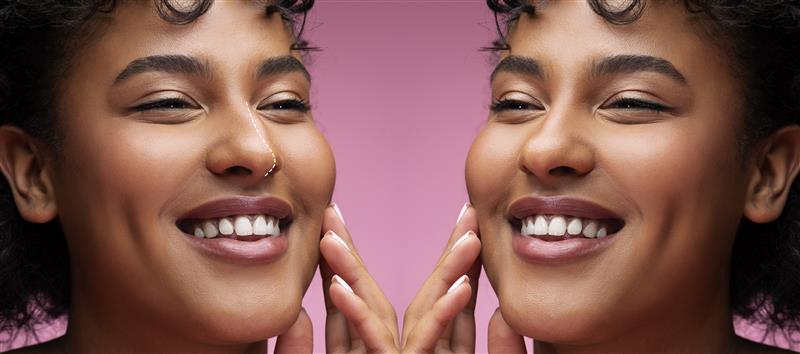 Plastic surgeon planning nose reshaping